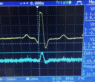 EKG